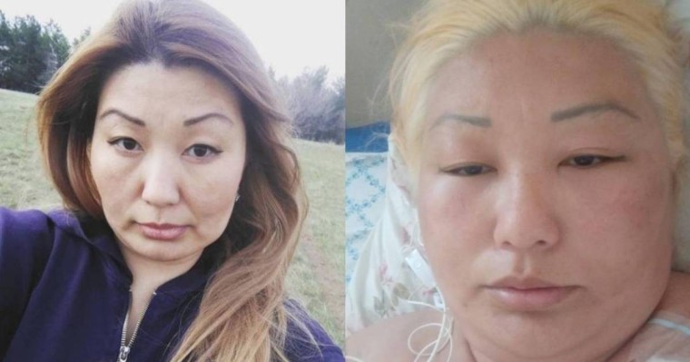 Оралда салонда шашын боятқан әйел аурухананың жансақтау бөлімінен бір-ақ шықты