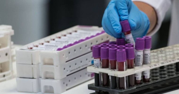 Қазақстанда коронавирус симптомдары жоқ науқастар саны артты