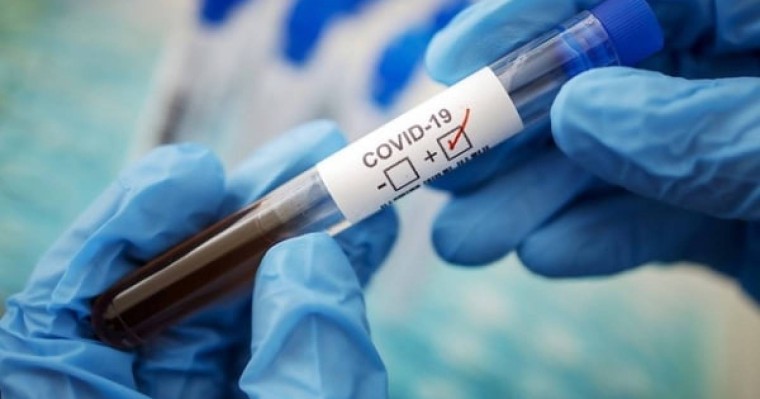 Министрлік Қазақстандағы Covid-19 және пневмония бойынша соңғы ақпаратты жариялады