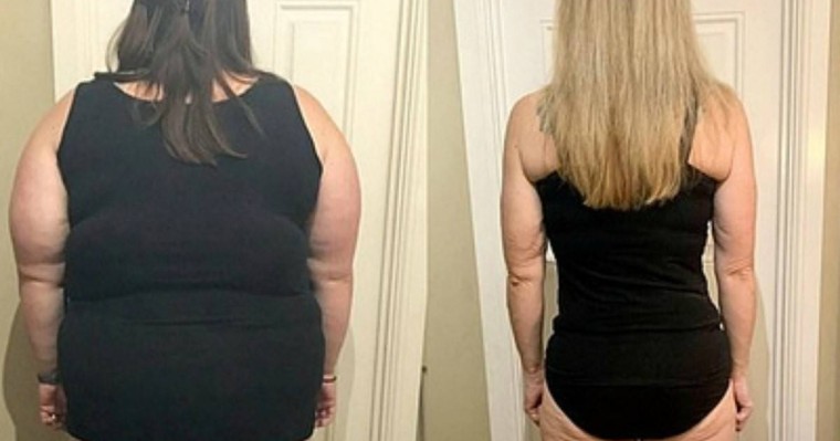 Әйел 76 келіден арылып, артық салмақ жоғалтудың тиімді әдісін ашты - Қазақстан жаңалықтары