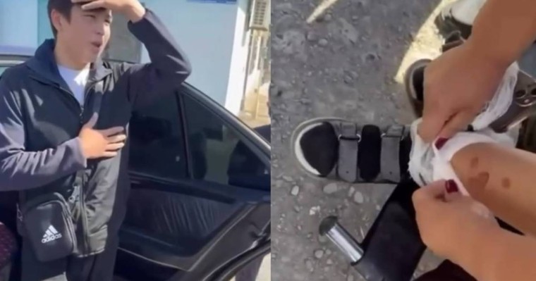Мүгедек баланың аяғын әдейі күйдіріп қорлаған жасөспірімдер жұрт ашуын туғызды