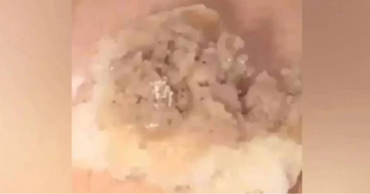 Жетісуда мектеп асханасындағы самсадан ақ құрттар шықты