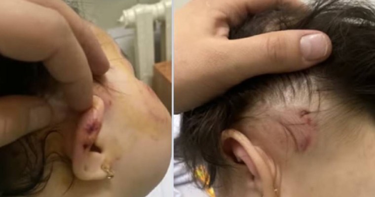 Балабақшада бір жарым жасар қызды ұрып-соқты: Оқиғаға қатысты мәліметтер шықты