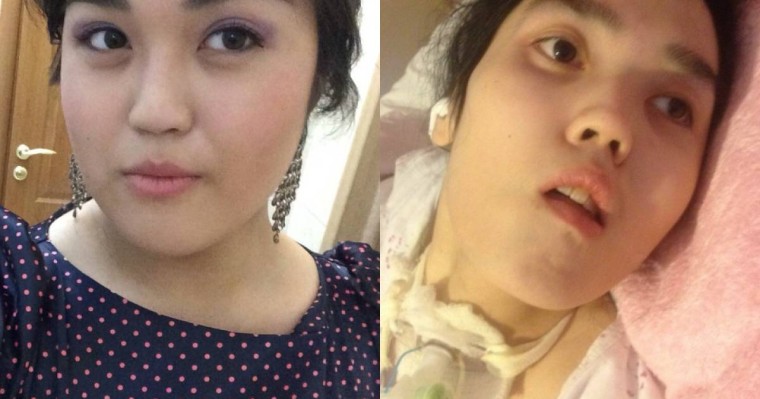 Төсекке таңылған қыздың анасы: Аяғымен барған баланы қолға көтеріп келдік