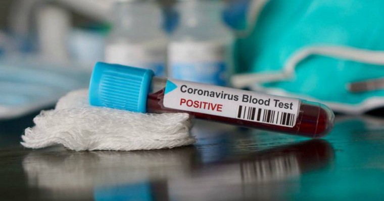 Қызылорда облысында 82 жастағы қария коронавирус жұқтырды - Қазақстан жаңалықтары