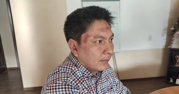 Тергеу органдарына сенбейтінін айтқан қырғыз журналисі өзіне жасалған шабуылды зерттейтінін айтты