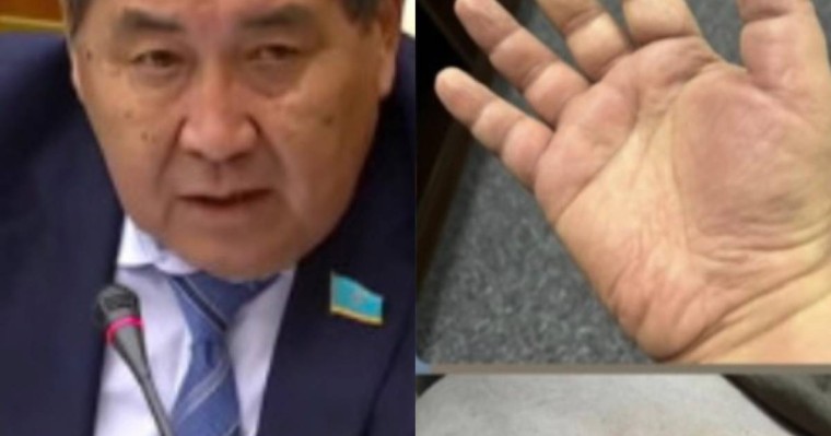 "Улаған деген күдік бар". Депутат Ермұрат Бәпи денсаулығы туралы айтты