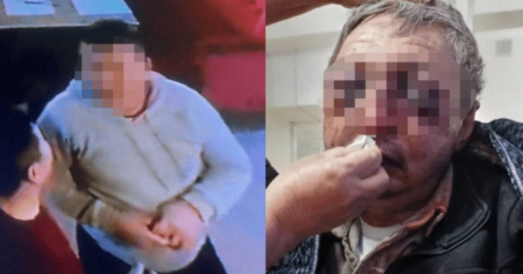 Шымкентте ер адам күзетшіні "қарға отырма" дегені үшін аяусыз ұрып-соққан