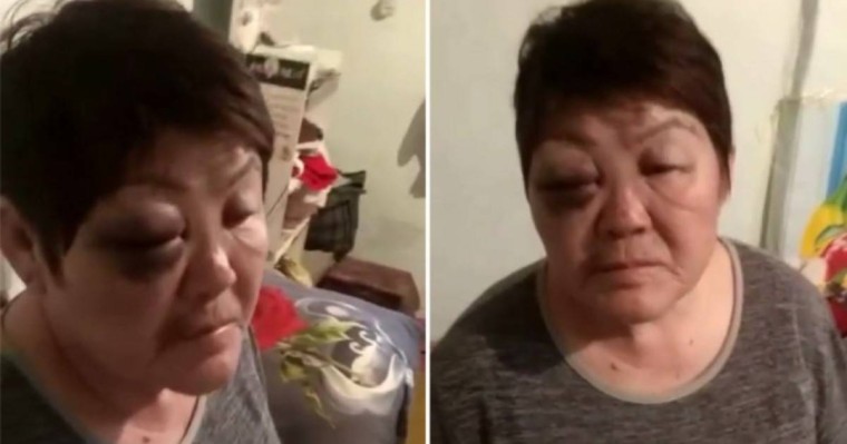 "Балаларыңмен бірге өртеп жіберемін деп қорқытты": Алматы облысының тұрғыны бұрынғы күйеуінің аяусыз ұрғанын айтты