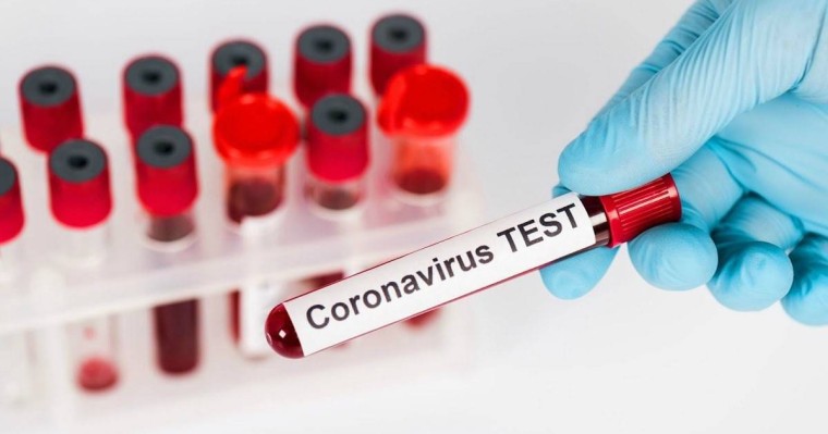 Павлодарда ерлі-зайыптылар COVID-19-дан көз жұмды - Қазақстан жаңалықтары