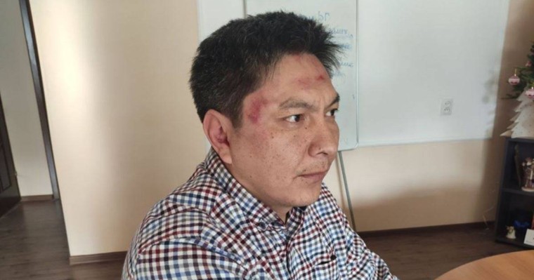 Бішкекте FactCheck.kg сайтының бас редакторын ұрып кетті