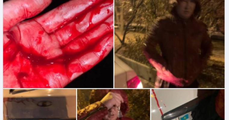 Қолын көтеріп, кесіп тастады: алматылық әйел өзіне шабуыл жасаған такси жүргізушісі туралы айтты