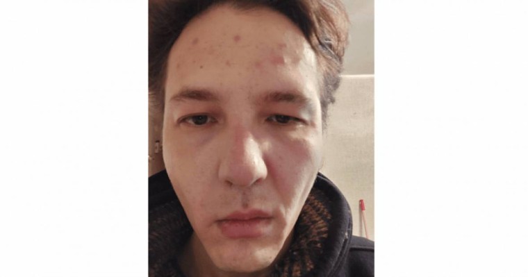 “Тыныш жүр” деп ұрып кетті”: Тәуелсіз журналист Данияр Молдабековке шабуыл жасалды