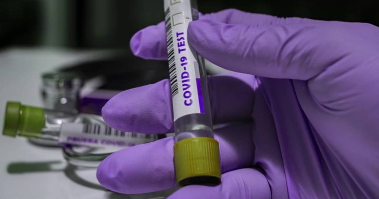 Бір тәулікте ковидпен ауырғандар саны 700-ден асты