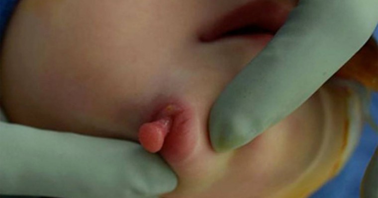 Екі ауызы мен екі тілі бар қыз дүниеге келді - Қазақстан жаңалықтары