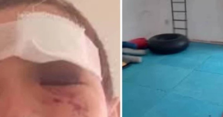 Оралда бес жасар бала MMA үйірмесіндегі қайғылы жағдайдан кейін бір көзінен айырылды