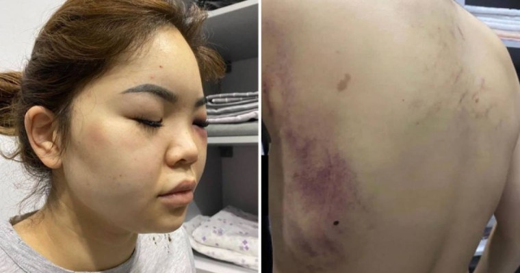 Астаналық әйелді бұрынғы күйеуі оңдырмай сабап тастады