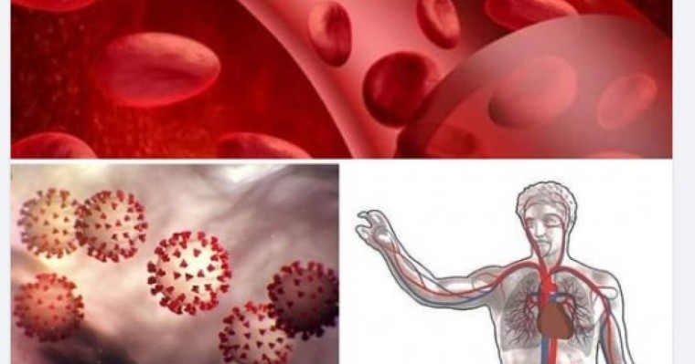 Көп адам тірі қалар еді: Коронавирусты емдеуде тың жаңалық ашылды