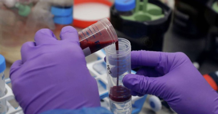 Коронавируспен ауырмаған адамдардан антидене анықталды – ғалымдар себебін айтты