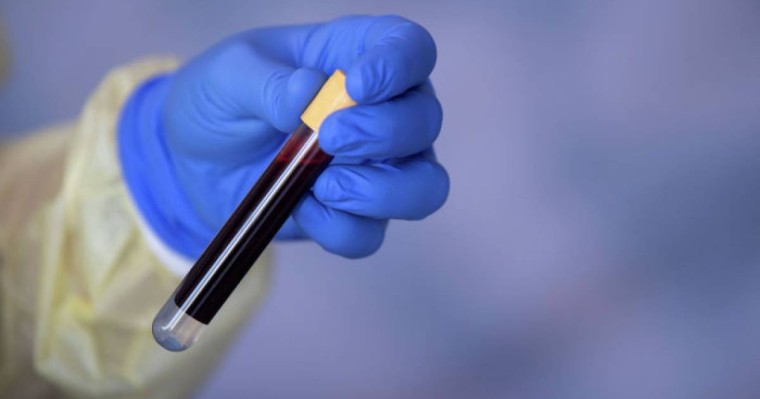 Президент дәрігерлер үшін қылмыстық жазаны өзгертуді ұсынды