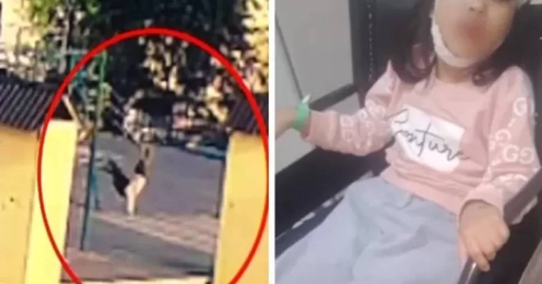 "Бас сүйегі мен жағы сынған": Астанада 6 жасар қыз әткеншектен оңбай құлады