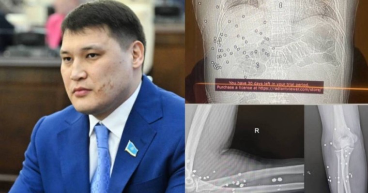 "Асфальтта құлап, дұға оқып жатты": Берденовке жасалған қастандықты көзімен көргендер куәлік етті