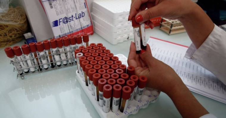 Роспотребнадзор ТМД елдері үшін коронавируспен күрес жөнінде кеңес өткізеді