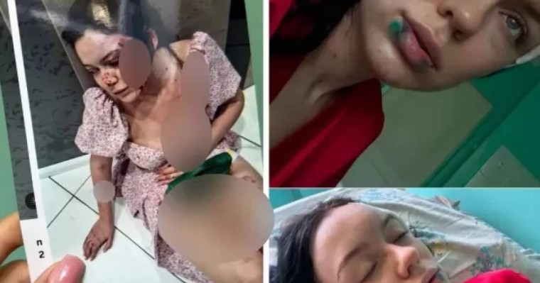 "Басымды қабырғаға соғып, қылқындырды": Екібастұзда қызды бұрынғы жігіті бір сағаттан астам уақыт ұрып-соққан