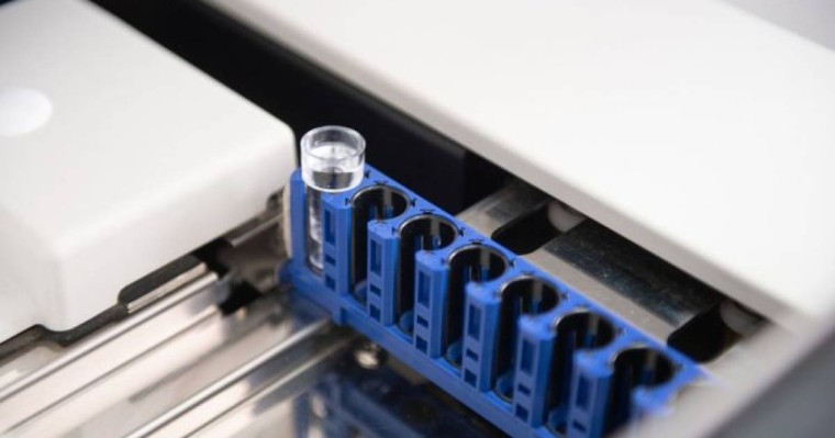 Ресейлік танымал актриса коронавирус жұқтырды