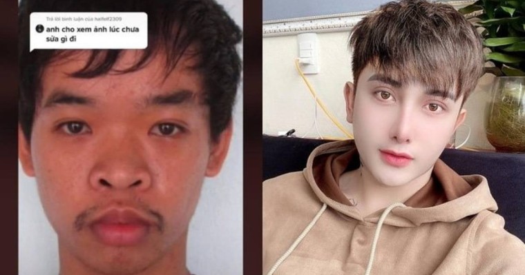 "Ұсқынсыз түріне бола" жұмысқа тұра алмаған жігіт отадан кейін танымастай өзгеріп кетті (фото)