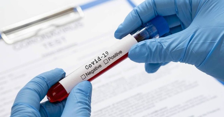 "Қазақмыс" шахтасында коронавирус жұқтырғандардың саны 4 есеге өсті - Қазақстан жаңалықтары