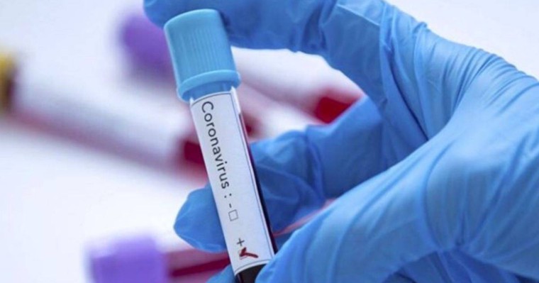 Қарағанды ​​облысында коронавирустың өршуі: жұқтырғандар жайлы не белгілі - Қазақстан жаңалықтары