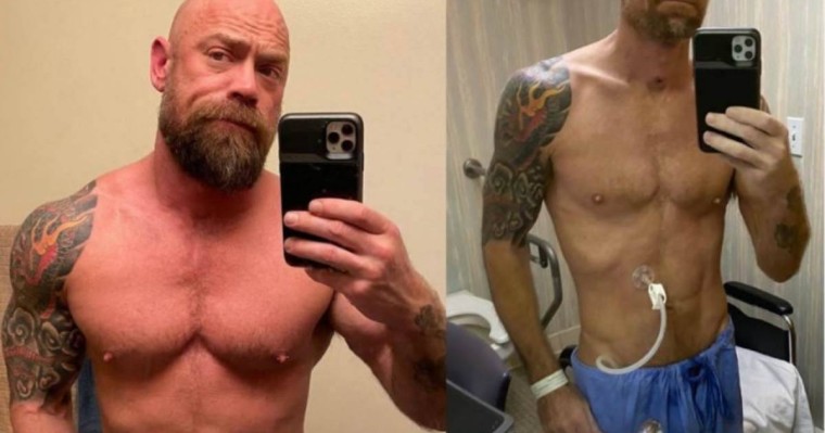 Медқызметкер коронавирустан кейін күрт өзгерген денесін көрсетті - Қазақстан жаңалықтары