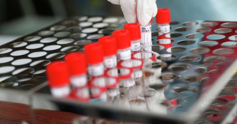 Қазақстанда індетті жұқтырғандардың саны 7234 адамға жетті