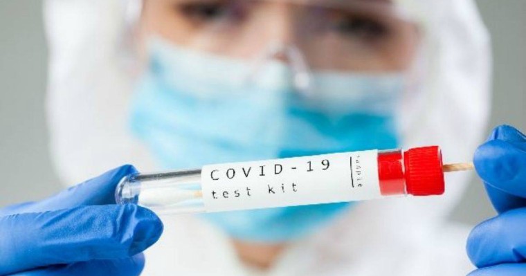 COVID-19-дың адамға жұғуының ерекше жағдайы тіркелді - Қазақстан жаңалықтары