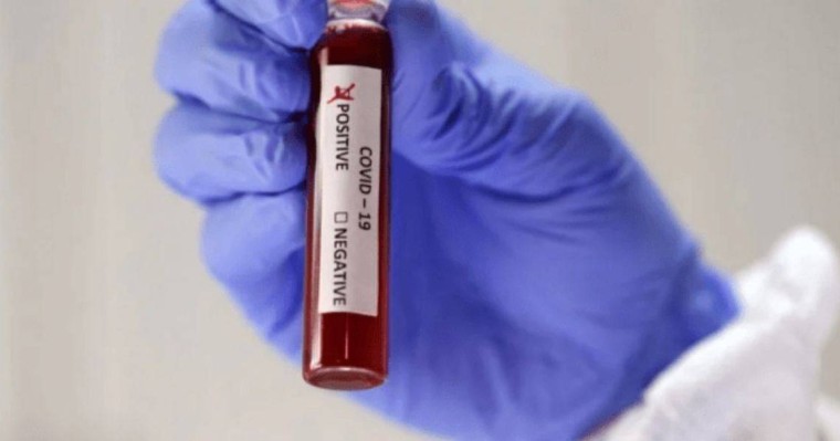 Қазақстанда тағы 311 адам коронавирус жұқтырды - Қазақстан жаңалықтары