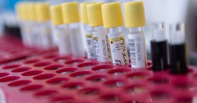 Белгілі құқық қорғаушы Өтебековтің шағымына инфекционист дәрігер жауап берді