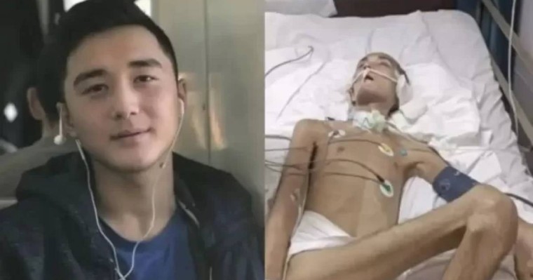 Түркиядан оралған Ербаян Мұхтарды қазақстандық дәрігерлер аяққа тұрғыза ала ма – министрдің жауабы