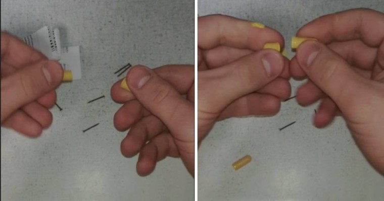 Ішінде шегесі бар асқазан дәрісі түсірілген видео таралып жатыр (видео)