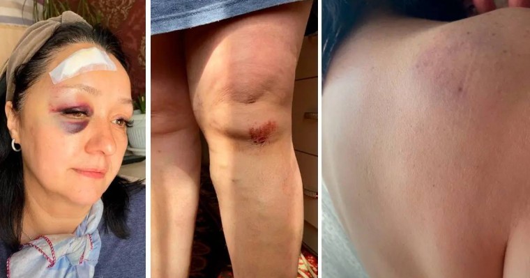 Алматыда әйелді темір сойылмен ұрған адамға қатысты қылмыстық іс қозғалды