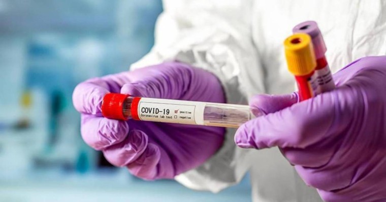 Қазақстанда коронавирус жұқтырғандар күрт өсті