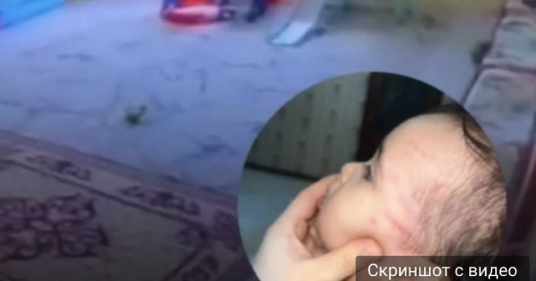 Балабақшаға екі күн барған сәбиді қызметкер ұрып тастаған (видео)