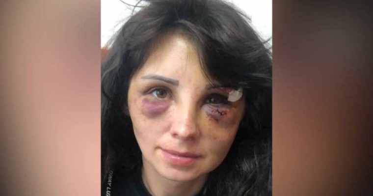 "Мен бәрін сатып алам, ешкім көмектесе алмайды": Азап көрген әйелдің оқиғасы қазақстандықтарды шошытты - Қазақстан жаңалықтары