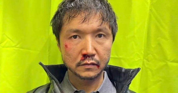 Бет-аузы қан жоса болған Бағлан Әбдірайымовтың суреті жұртты шошытты (фото, видео)