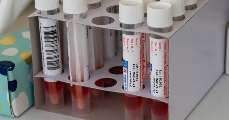 Өскемендегі оң нәтиже көрсеткен ПТР сынақтарының жартысы жалған болып шықты