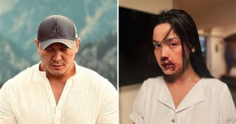 Режиссер Жігер Ауыпбаевқа "Ақботаны зорлайсың" деген талап қойған