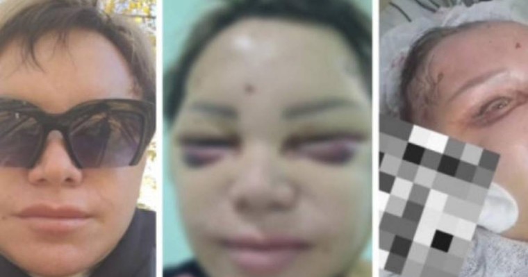 Сұлулық салонына барған көкшетаулық тұрғын мерт бола жаздаған