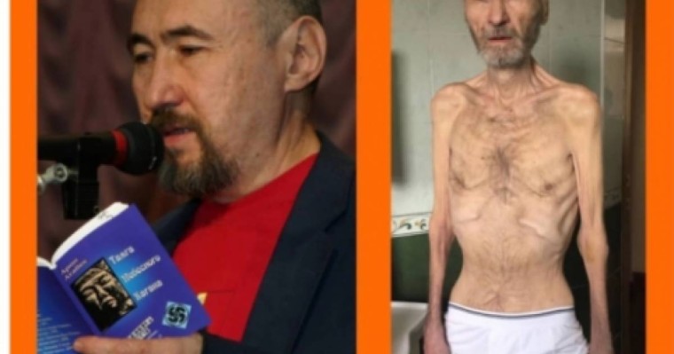 Аса ауыр жағдайда: Арон Атабектің қызы шұғыл мәлімдеме жасады