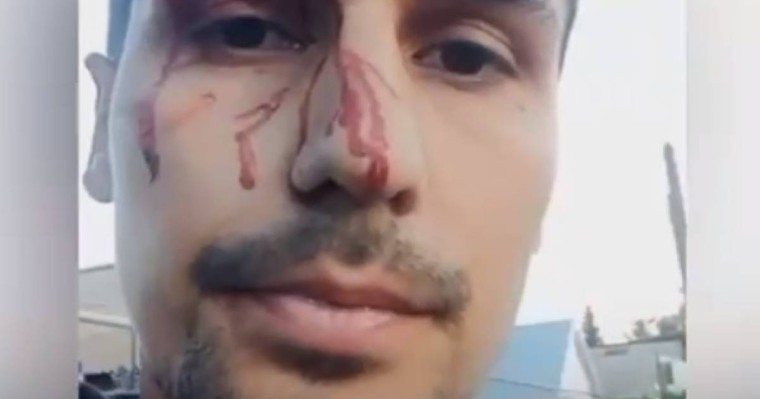 Тоқаевқа шындықты айтқан жігітті әкімдік қызметкерлері соққыға жыққан (ВИДЕО)