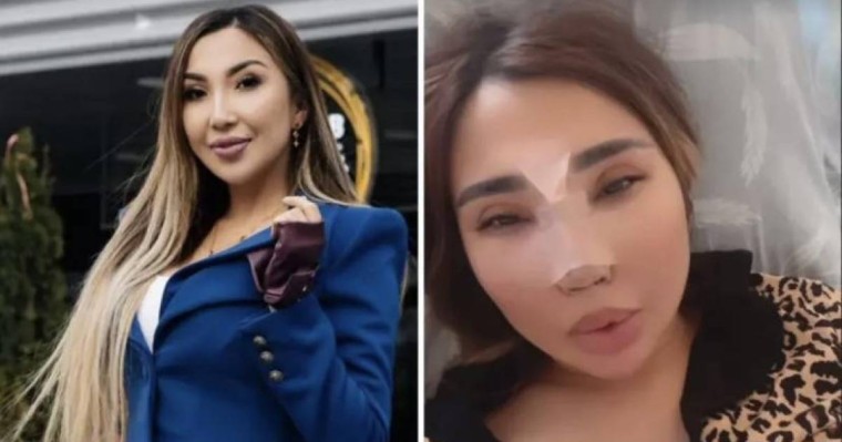 "Үсті-басым қан болды". Сиви Махмуди жан түршігерлік жол апатына түскенін айтты